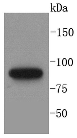 MLH1 Recombinant Rabbit Monoclonal Antibody (SP08-04):Antibodies, Recombinant