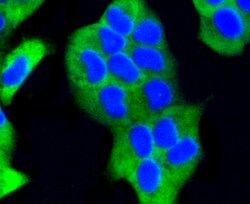 Invitrogen PHD1 Recombinant Rabbit Monoclonal Antibody (SP00-48) 100 &mu;L;