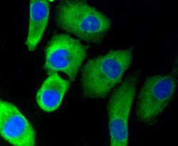 Invitrogen PHD1 Recombinant Rabbit Monoclonal Antibody (SP00-48) 100 &mu;L;