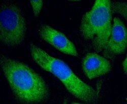 Invitrogen PHD1 Recombinant Rabbit Monoclonal Antibody (SP00-48) 100 &mu;L;