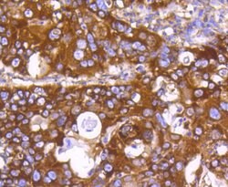 Invitrogen PHD1 Recombinant Rabbit Monoclonal Antibody (SP00-48) 100 &mu;L;