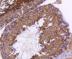 Invitrogen PHD1 Recombinant Rabbit Monoclonal Antibody (SP00-48) 100 &mu;L;