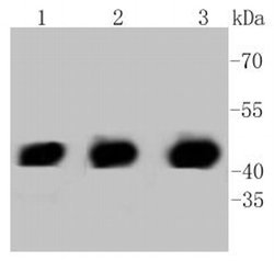 Invitrogen PHD1 Recombinant Rabbit Monoclonal Antibody (SP00-48) 100 &mu;L;