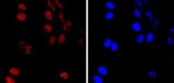 Invitrogen PMS2 Recombinant Rabbit Monoclonal Antibody (SY08-09) 100 &mu;L;