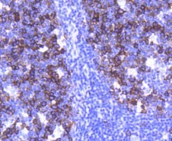 Invitrogen TACC3 Recombinant Rabbit Monoclonal Antibody (SY10-06) 100 &mu;L;