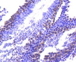 Invitrogen TACC3 Recombinant Rabbit Monoclonal Antibody (SY10-06) 100 &mu;L;