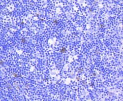 Invitrogen TACC3 Recombinant Rabbit Monoclonal Antibody (SY10-06) 100 &mu;L;