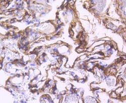 Invitrogen CD140b (PDGFRB) Recombinant Rabbit Monoclonal Antibody (SY10-08) 100 &mu;L | Buy Online | Invitrogen&trade; | Fisher Scientific