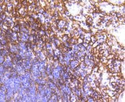 Invitrogen CD140b (PDGFRB) Recombinant Rabbit Monoclonal Antibody (SY10-08) 100 &mu;L | Buy Online | Invitrogen&trade; | Fisher Scientific