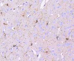 Invitrogen CD140b (PDGFRB) Recombinant Rabbit Monoclonal Antibody (SY10-08) 100 &mu;L | Buy Online | Invitrogen&trade; | Fisher Scientific