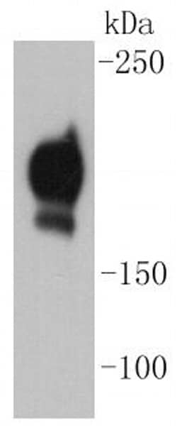 Invitrogen CD140b (PDGFRB) Recombinant Rabbit Monoclonal Antibody (SY10-08) 100 &mu;L | Buy Online | Invitrogen&trade; | Fisher Scientific