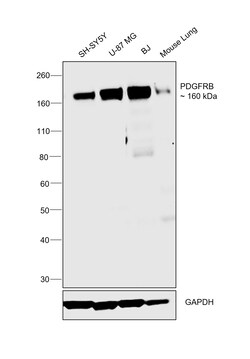 Invitrogen CD140b (PDGFRB) Recombinant Rabbit Monoclonal Antibody (SY10-08) 100 &mu;L | Buy Online | Invitrogen&trade; | Fisher Scientific