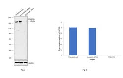Invitrogen CD140b (PDGFRB) Recombinant Rabbit Monoclonal Antibody (SY10-08) 100 &mu;L | Buy Online | Invitrogen&trade; | Fisher Scientific