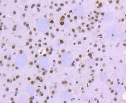 Invitrogen FUBP1 Recombinant Rabbit Monoclonal Antibody (SY11-04) 100 &mu;L;