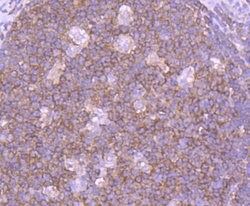 Invitrogen SHIP1 Recombinant Rabbit Monoclonal Antibody (SY11-08) 100 &mu;L;