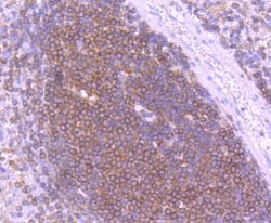 Invitrogen SHIP1 Recombinant Rabbit Monoclonal Antibody (SY11-08) 100 &mu;L;