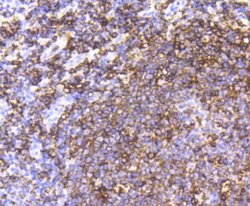 Invitrogen CD20 Recombinant Rabbit Monoclonal Antibody (SY12-01) 100 &mu;L | Buy Online | Invitrogen&trade; | Fisher Scientific