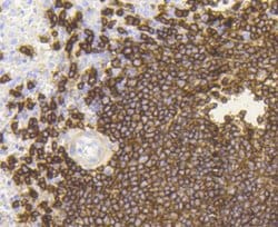 Invitrogen CD20 Recombinant Rabbit Monoclonal Antibody (SY12-01) 100 &mu;L | Buy Online | Invitrogen&trade; | Fisher Scientific