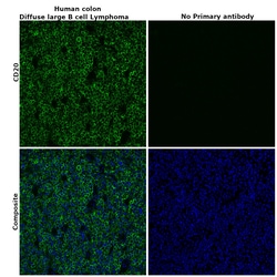 Invitrogen CD20 Recombinant Rabbit Monoclonal Antibody (SY12-01) 100 &mu;L | Buy Online | Invitrogen&trade; | Fisher Scientific