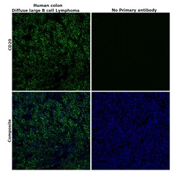 Invitrogen CD20 Recombinant Rabbit Monoclonal Antibody (SY12-01) 100 &mu;L | Buy Online | Invitrogen&trade; | Fisher Scientific