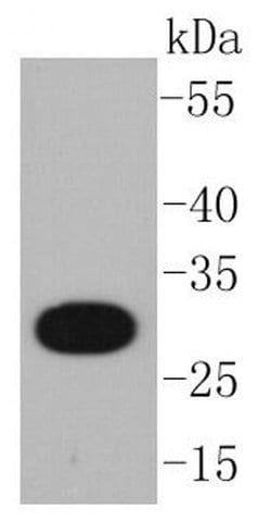 Invitrogen CD20 Recombinant Rabbit Monoclonal Antibody (SY12-01) 100 &mu;L | Buy Online | Invitrogen&trade; | Fisher Scientific