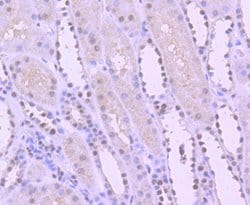 Invitrogen YY1 Recombinant Rabbit Monoclonal Antibody (SY29-01) 100 &mu;L;
