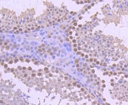 Invitrogen YY1 Recombinant Rabbit Monoclonal Antibody (SY29-01) 100 &mu;L;