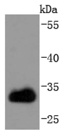 Invitrogen CDK1 Recombinant Rabbit Monoclonal Antibody (SM01-44) 100 &mu;L | Buy Online | Invitrogen&trade; | Fisher Scientific