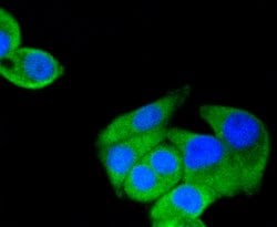 Invitrogen HSP90 alpha Recombinant Rabbit Monoclonal Antibody (SY14-06)