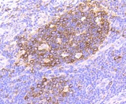 Invitrogen HSP90 alpha Recombinant Rabbit Monoclonal Antibody (SY14-06)