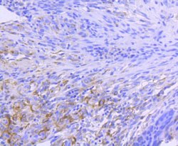 Invitrogen HSP90 alpha Recombinant Rabbit Monoclonal Antibody (SY14-06)