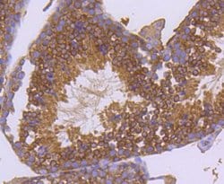 Invitrogen HSP90 alpha Recombinant Rabbit Monoclonal Antibody (SY14-06)