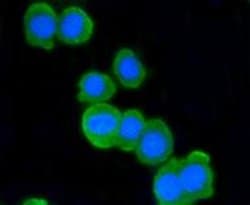 Invitrogen ATM Recombinant Rabbit Monoclonal Antibody (SI70-01) 100 &mu;L | Buy Online | Invitrogen&trade; | Fisher Scientific
