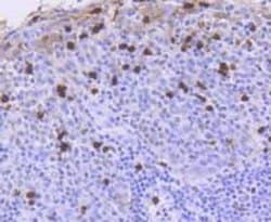 Invitrogen ATM Recombinant Rabbit Monoclonal Antibody (SI70-01) 100 &mu;L | Buy Online | Invitrogen&trade; | Fisher Scientific