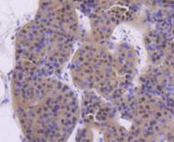 Invitrogen ATM Recombinant Rabbit Monoclonal Antibody (SI70-01) 100 &mu;L | Buy Online | Invitrogen&trade; | Fisher Scientific