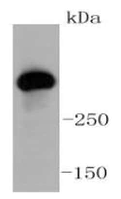 Invitrogen ATM Recombinant Rabbit Monoclonal Antibody (SI70-01) 100 &mu;L | Buy Online | Invitrogen&trade; | Fisher Scientific