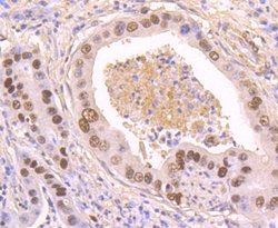 Invitrogen Phospho-p53 (Ser392) Recombinant Rabbit Monoclonal Antibody