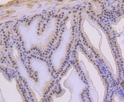 Invitrogen Phospho-p53 (Ser392) Recombinant Rabbit Monoclonal Antibody