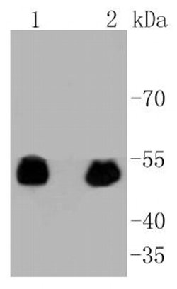 Invitrogen Phospho-p53 (Ser392) Recombinant Rabbit Monoclonal Antibody