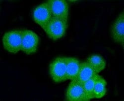 Invitrogen CD8 alpha Recombinant Rabbit Monoclonal Antibody (SI18-01) 100