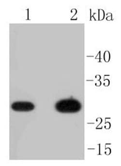 Invitrogen CD8 alpha Recombinant Rabbit Monoclonal Antibody (SI18-01) 100
