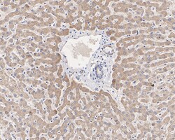 Invitrogen PIK3CA Recombinant Rabbit Monoclonal Antibody (SJ0186) 100 &mu;L;