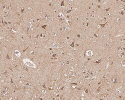 Invitrogen PIK3CA Recombinant Rabbit Monoclonal Antibody (SJ0186) 100 &mu;L;