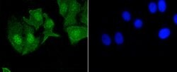 Invitrogen Phospho-EGFR (Tyr1092) Recombinant Rabbit Monoclonal Antibody