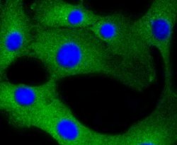 Invitrogen Calmodulin Recombinant Rabbit Monoclonal Antibody (SJ16-09) 100 &mu;L | Buy Online | Invitrogen&trade; | Fisher Scientific