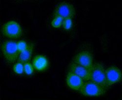 Invitrogen MMP14 Recombinant Rabbit Monoclonal Antibody (SJ18-09) 100 &mu;L;