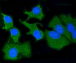 Invitrogen MMP14 Recombinant Rabbit Monoclonal Antibody (SJ18-09) 100 &mu;L;