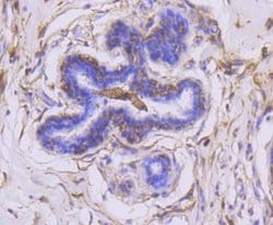 Invitrogen MMP14 Recombinant Rabbit Monoclonal Antibody (SJ18-09) 100 &mu;L;