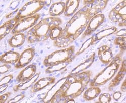 Invitrogen MMP14 Recombinant Rabbit Monoclonal Antibody (SJ18-09) 100 &mu;L;