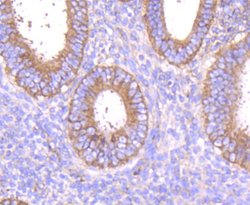 Invitrogen MMP14 Recombinant Rabbit Monoclonal Antibody (SJ18-09) 100 &mu;L;